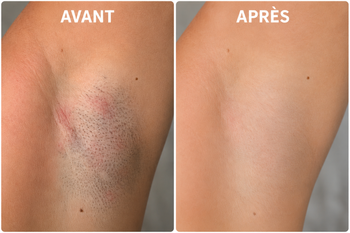 Miniature produit