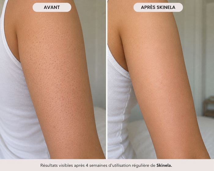 Avant après