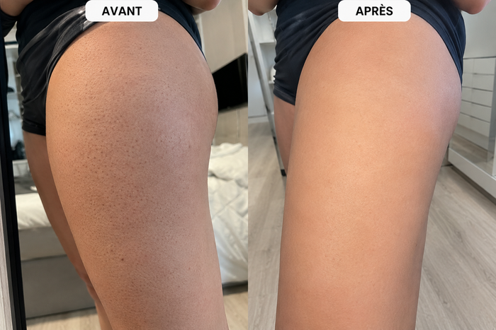 Avant après