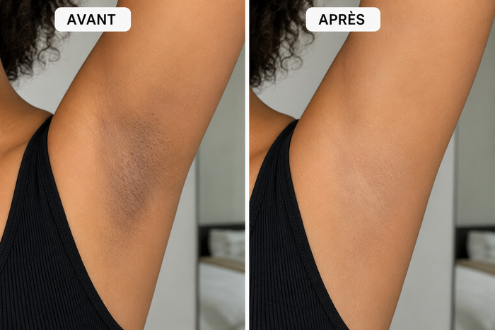 Avant après